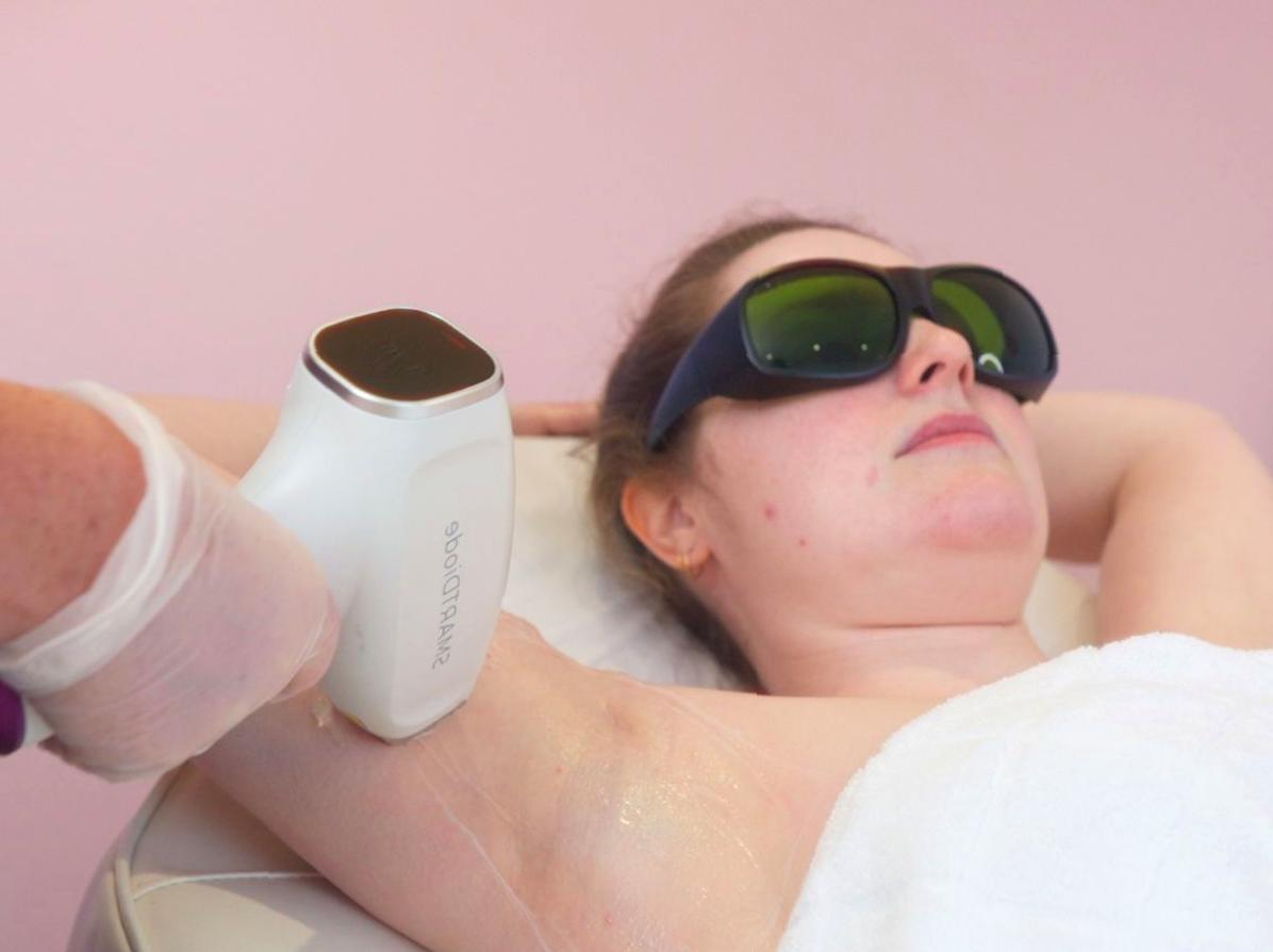 Achieving Flawless Underarms via Laser Hair Removal